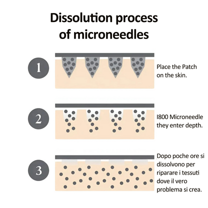 Microneedle Eye Patch